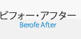 ビフォー・アフターBerofe After